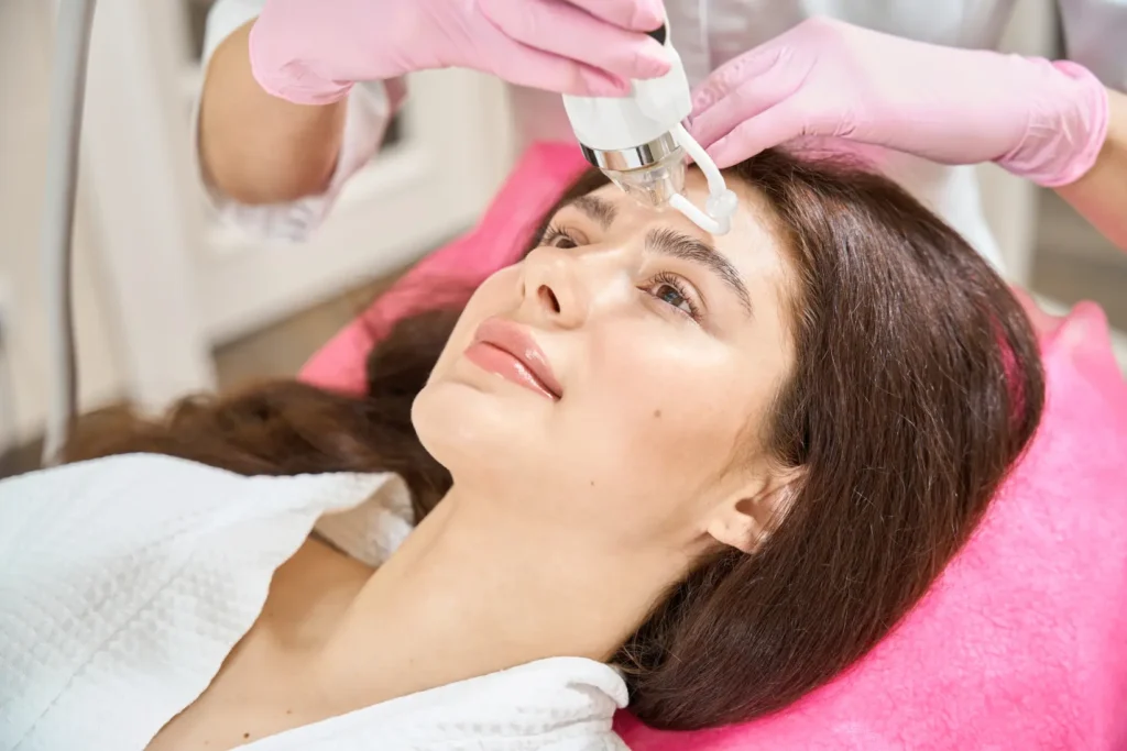 Vybe RF Microneedling